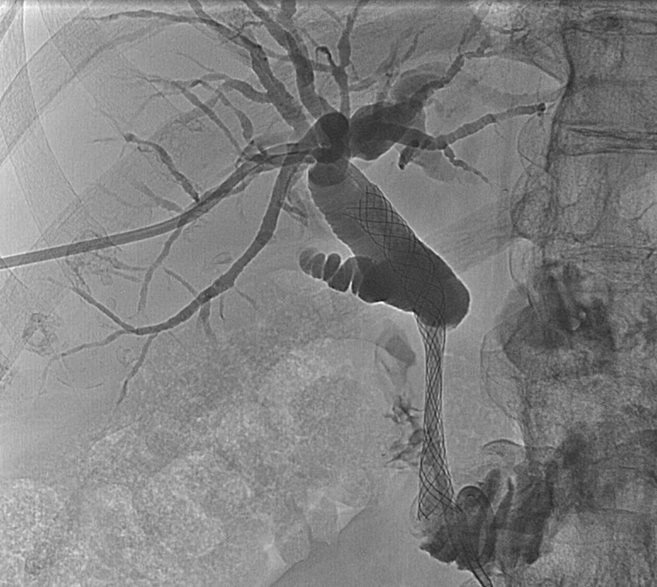 Resim-20-1024x620px.jpg