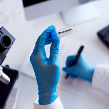 Monkeypox Virus